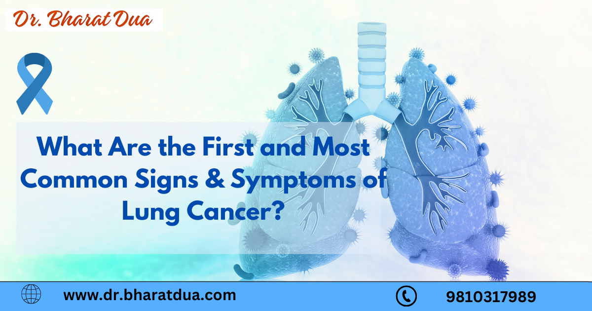 What Are the First and Most Common Signs & Symptoms of Lung Cancer?